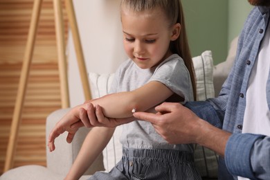 Photo of Father applying ointment onto his daughter's elbow on couch