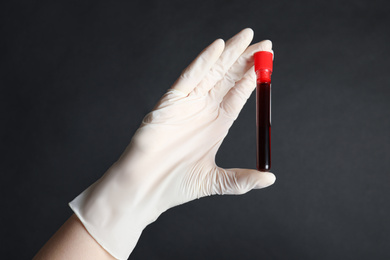 Photo of Scientist holding test tube with blood sample on black background, closeup. Virus research