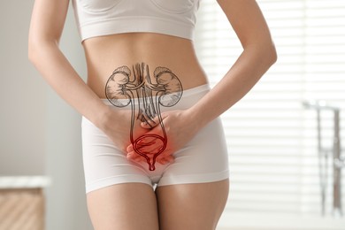 Woman suffering from cystitis at home, closeup. Illustration of urinary system