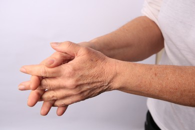 Photo of Closeup view of woman's hands with aging skin