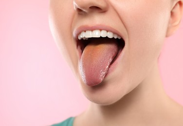 Photo of Gastrointestinal diseases. Woman showing her yellow tongue on pink background, closeup
