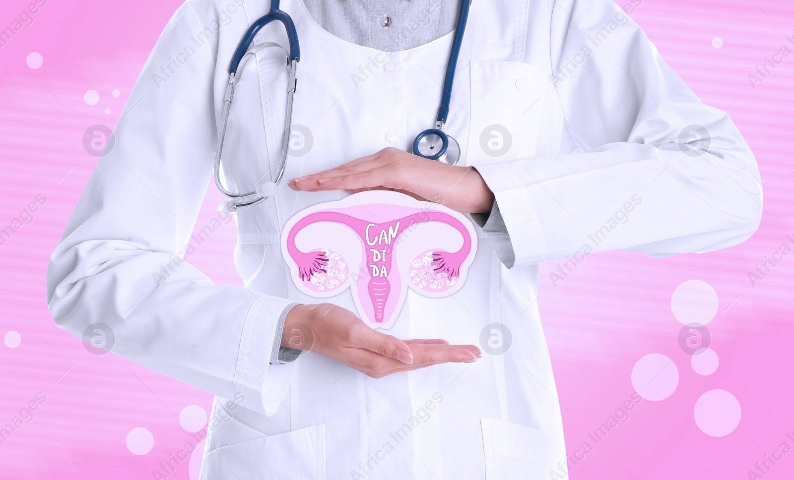 Image of Doctor demonstrating virtual image of infected female reproductive system on pink background, closeup. Vaginal candidiasis