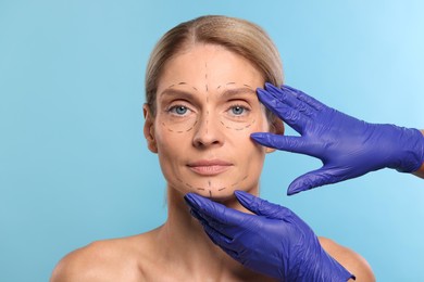 Doctor checking patient's face before cosmetic surgery operation on light blue background