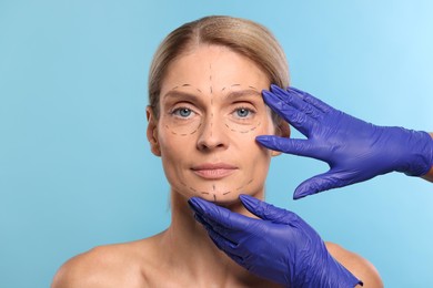 Photo of Doctor checking patient's face before cosmetic surgery operation on light blue background