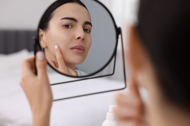 Woman with dry skin looking at mirror indoors