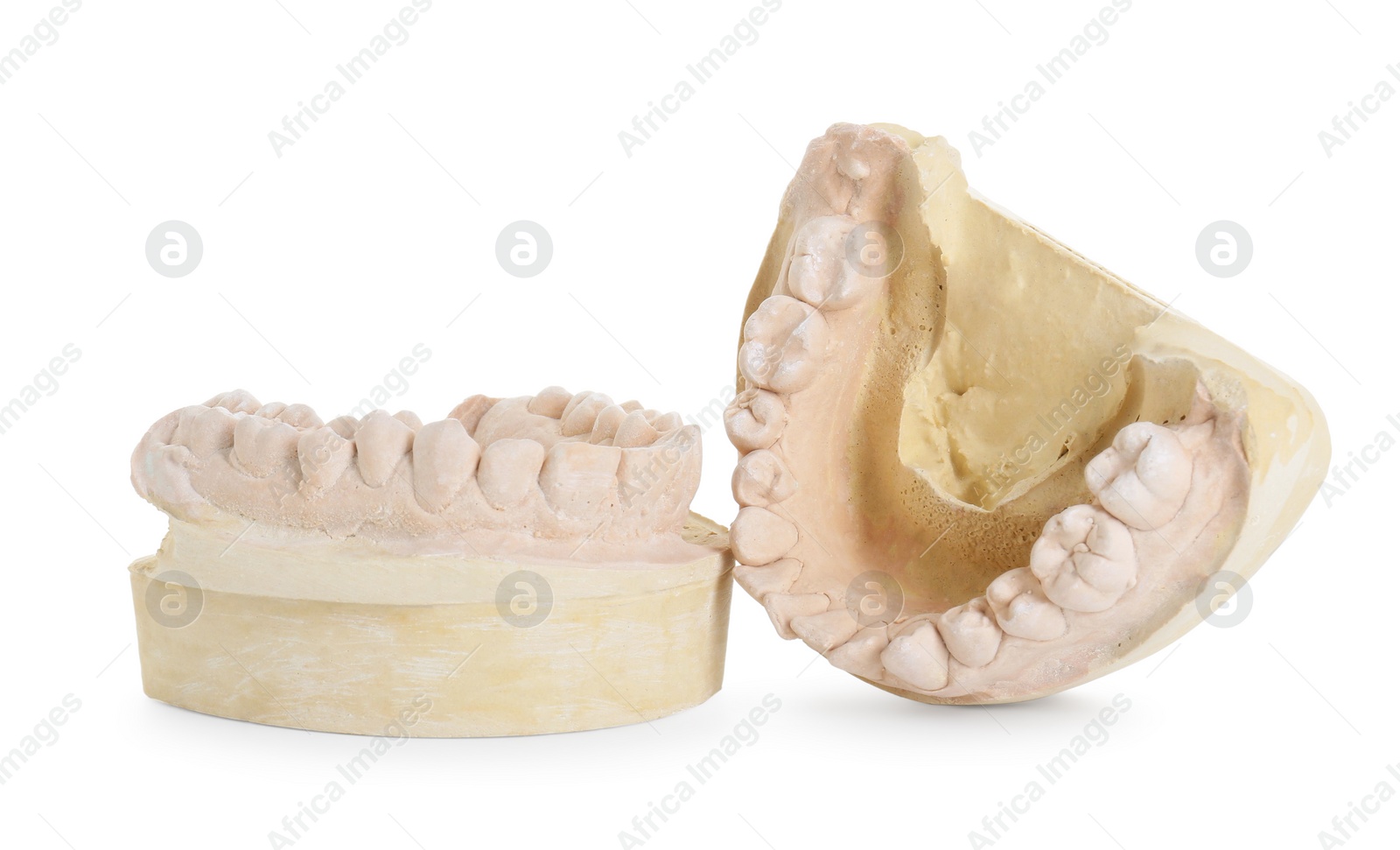 Photo of Dental model with jaws isolated on white. Cast of teeth