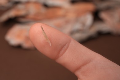 Woman with splinter in her finger outdoors, closeup