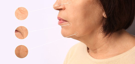 Image of Beautiful mature woman on white background, closeup. Zoomed skin areas showing wrinkles before rejuvenation procedures