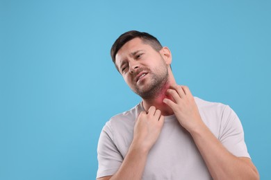 Photo of Allergy symptom. Man scratching his neck on light blue background. Space for text