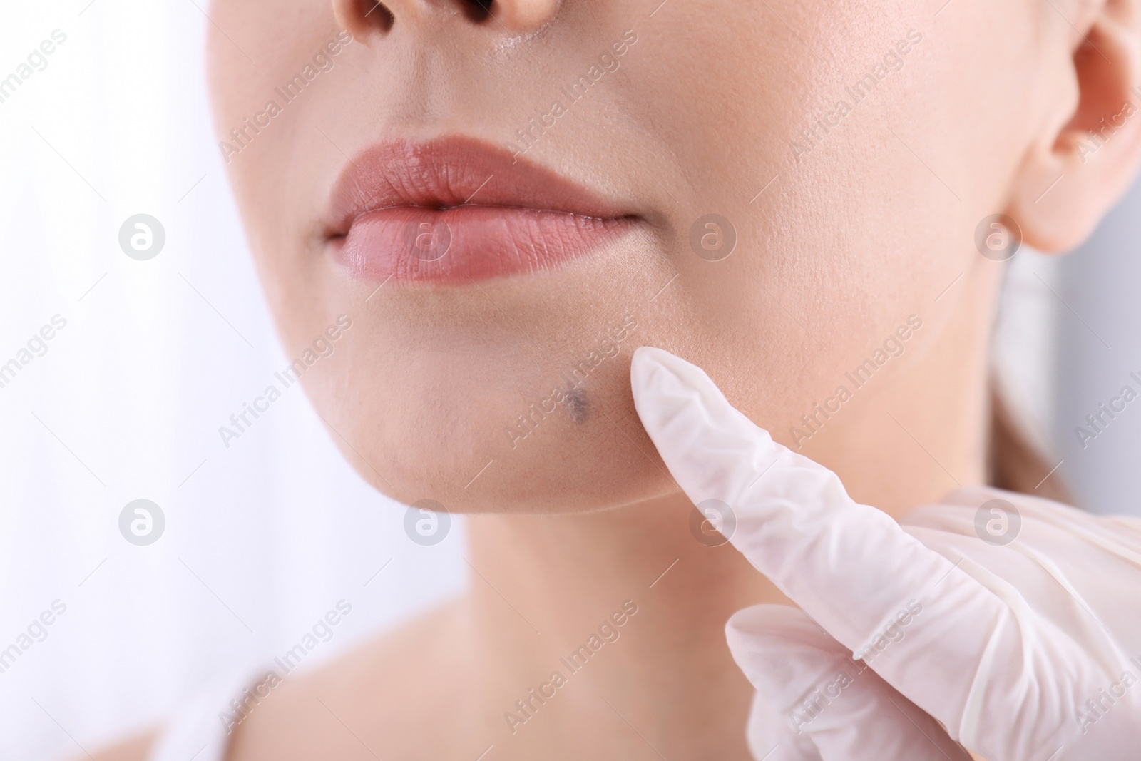 Photo of Dermatologist examining patient in clinic, closeup view