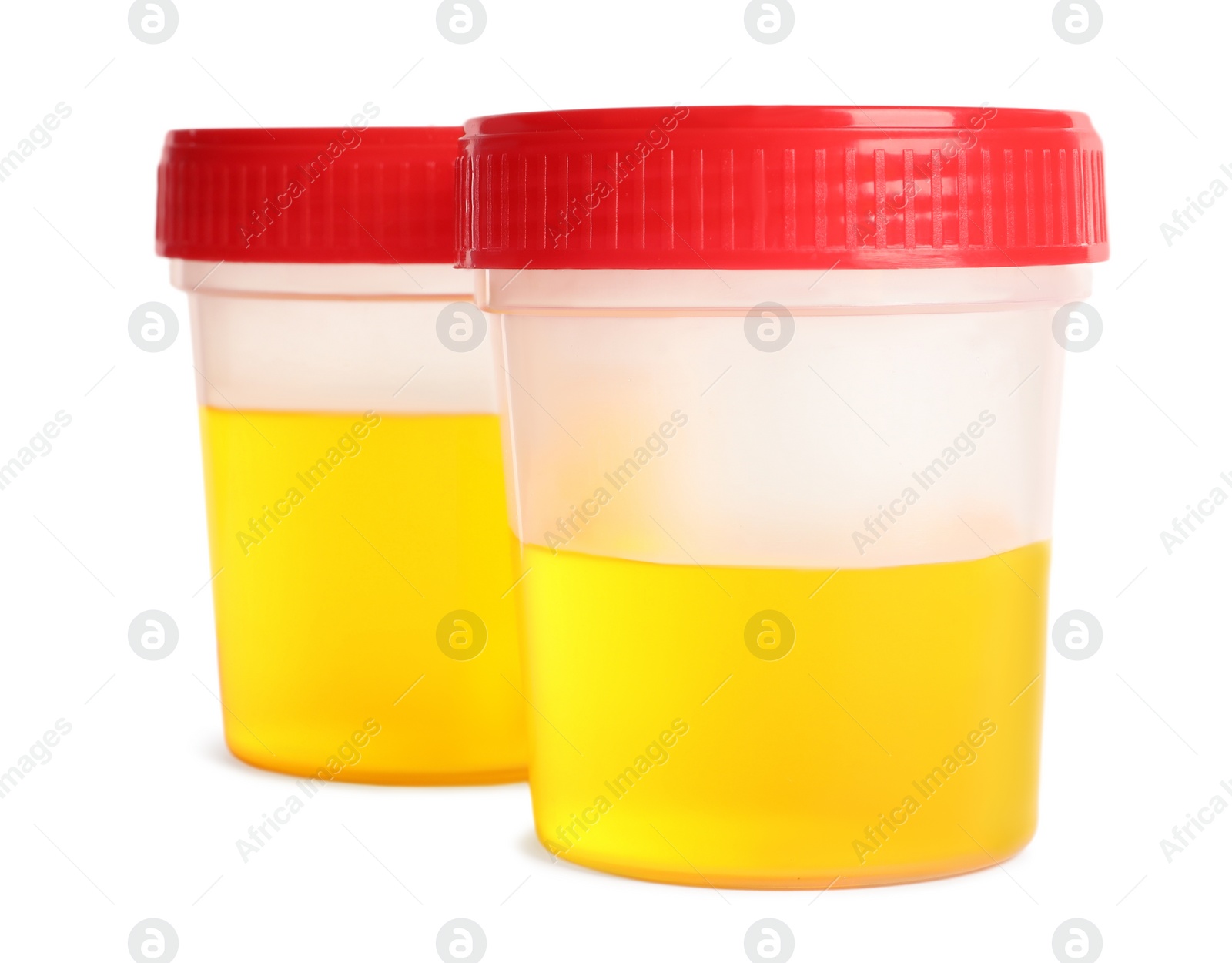 Photo of Containers with urine sample for analysis on white background