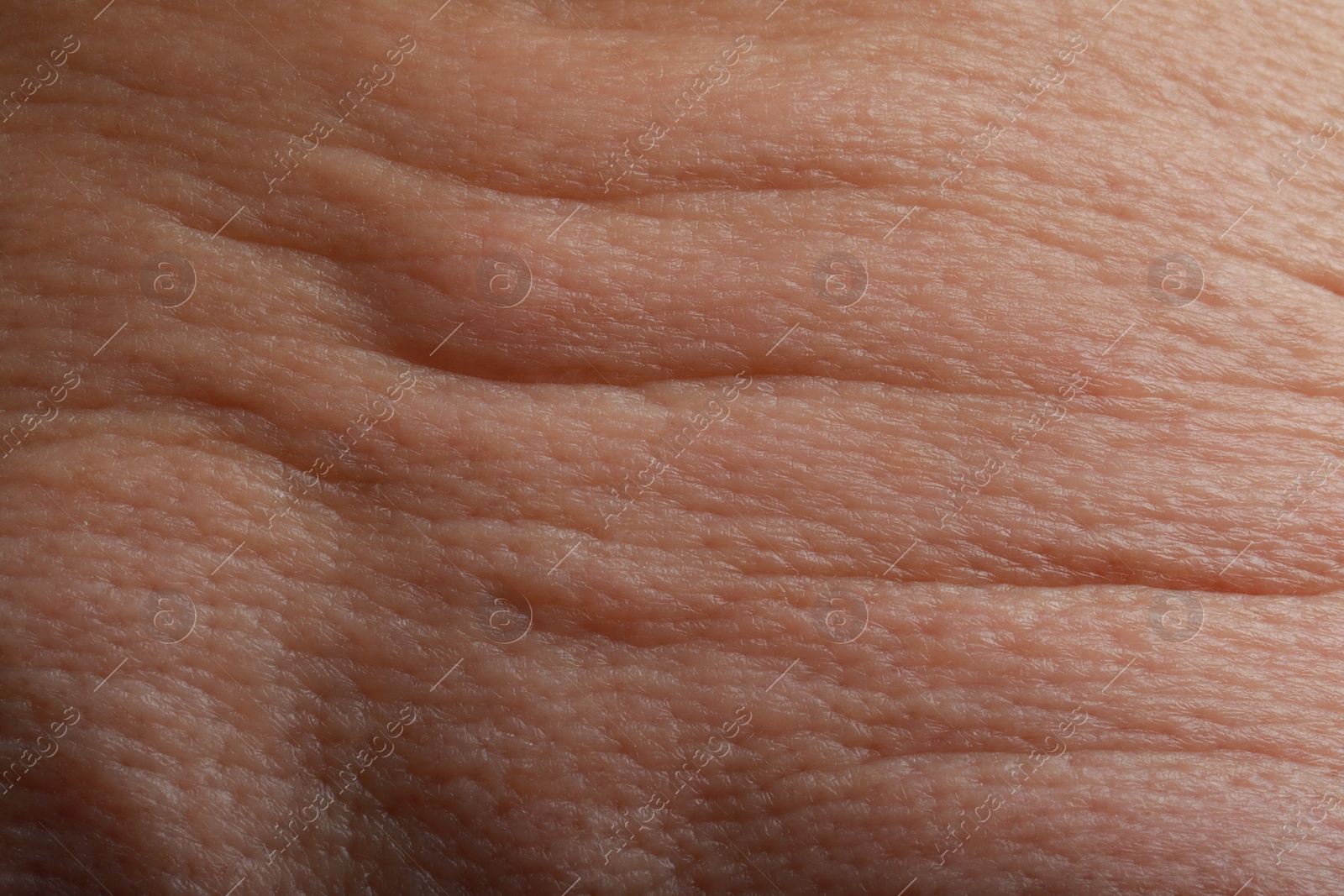 Photo of Closeup view of woman with normal skin