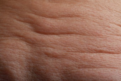 Photo of Closeup view of woman with normal skin