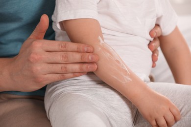 Photo of Father applying ointment onto his son`s arm, closeup