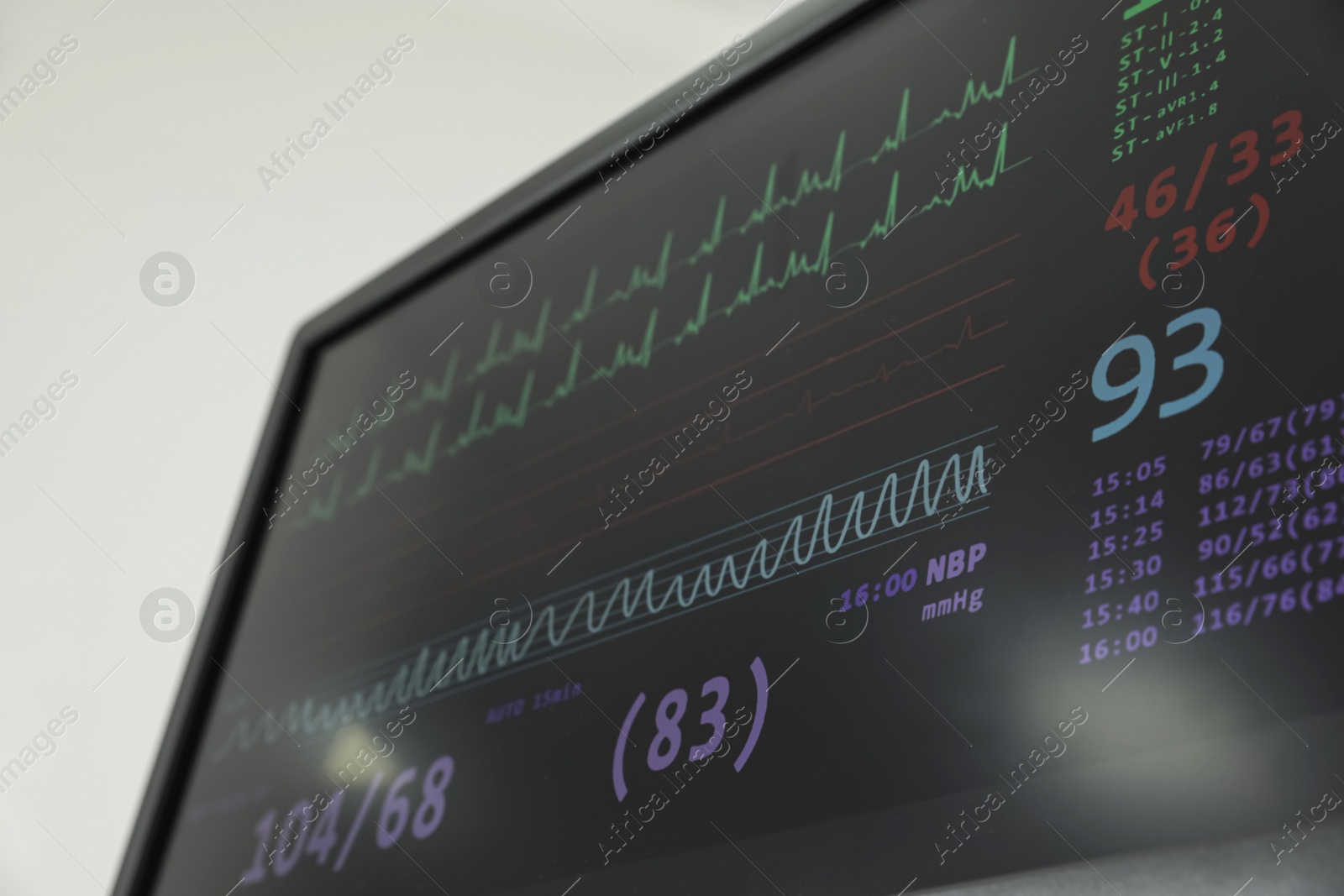 Photo of Black monitor with cardiogram in hospital, closeup