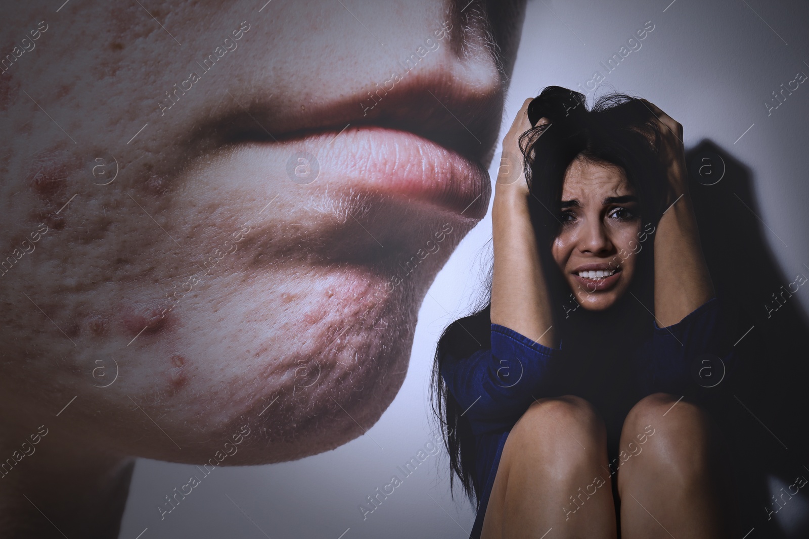 Image of Scared woman suffering from acnephobia. Vision of person with problem skin