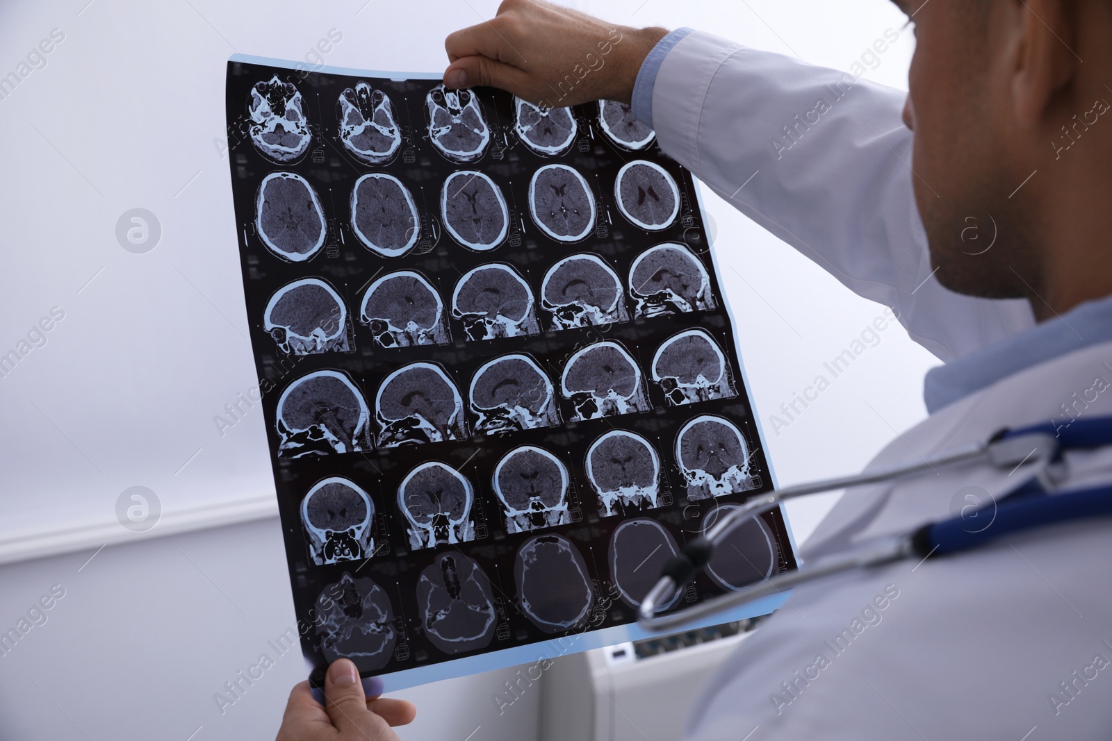 Photo of Doctor examining MRI images of patient with multiple sclerosis in clinic, closeup