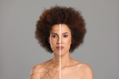 Image of Dry skin treatment. Beautiful woman before and after procedure on grey background, collage