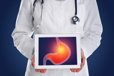 Treatment of heartburn and other gastrointestinal diseases. Doctor with tablet on dark blue background, closeup. Stomach illustration on screen