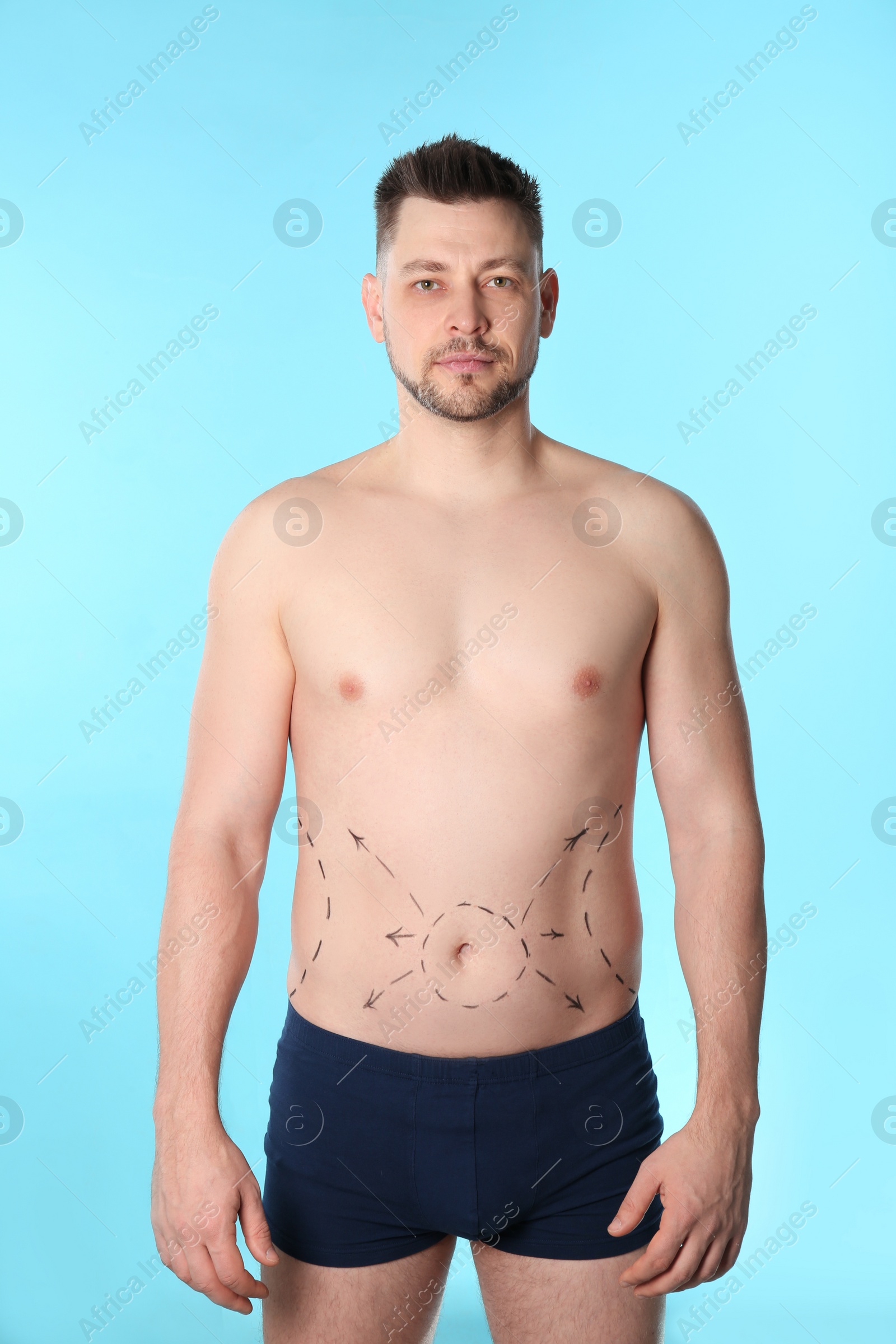 Photo of Man with marks on belly for cosmetic surgery operation against blue background