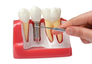 Photo of Woman pointing at dental implant between teeth in educational model on white background, closeup