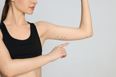 Photo of Slim young woman with marks on arm against light background, closeup. Weight loss surgery