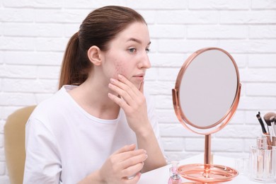 Woman with acne problem looking at mirror indoors