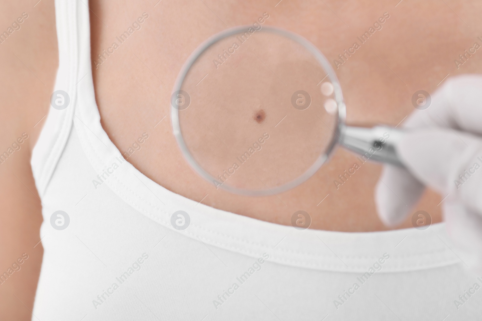 Photo of Dermatologist examining patient with magnifying glass in clinic, closeup view