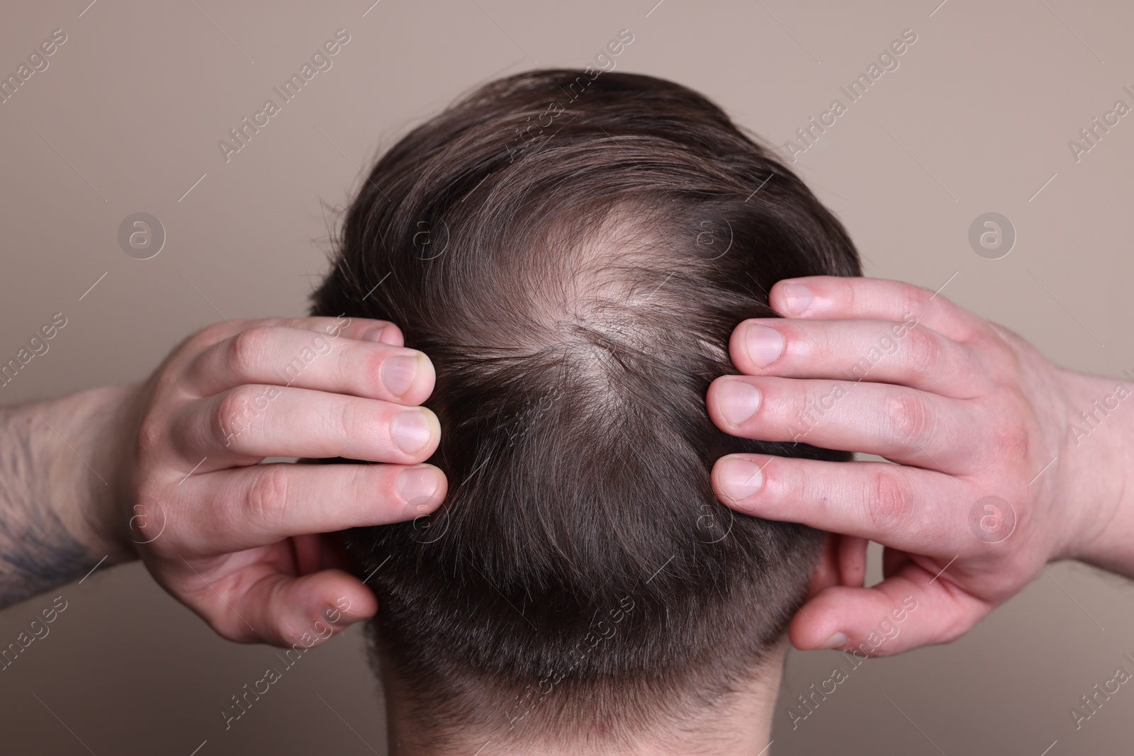 Photo of Baldness concept. Man with bald spot on beige background, back view
