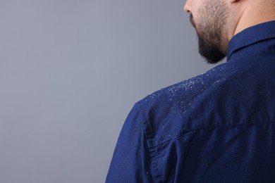 Man with dandruff on his shirt against grey background, closeup. Space for text