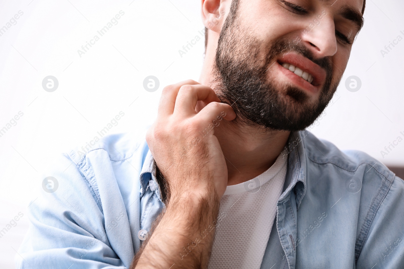 Photo of Young man scratching neck indoors, closeup. Allergies symptoms