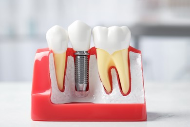 Photo of Educational model of gum with dental implant between teeth on white table indoors