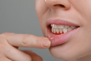 Image of Woman showing inflamed gum on grey background, closeup