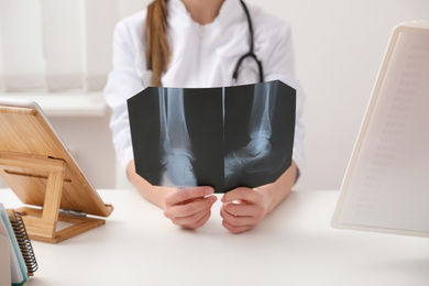 Orthopedist examining X-ray picture at desk in office, closeup