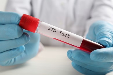 Scientist holding tube with blood sample and label STD Test at white table, closeup