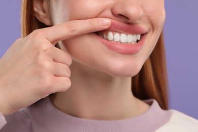 Photo of Woman showing her clean teeth on violet background, closeup