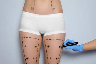 Photo of Doctor drawing marks on female legs for cosmetic surgery operation against color background
