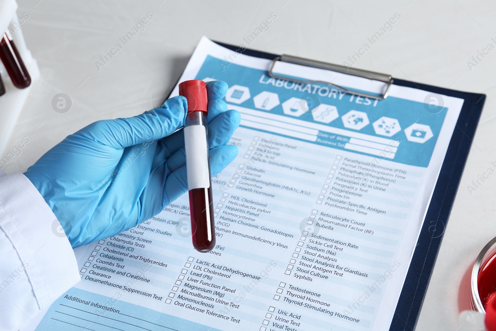 Photo of Laboratory worker holding test tube with blood sample for analysis beside medical form, closeup