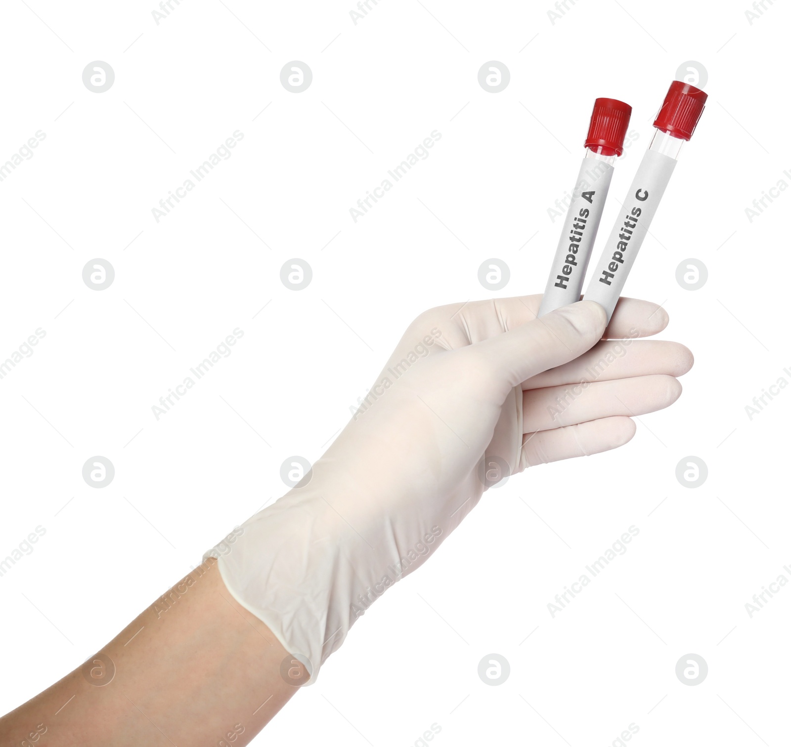 Photo of Scientist holding tubes with blood samples for hepatitis virus test on white background, closeup