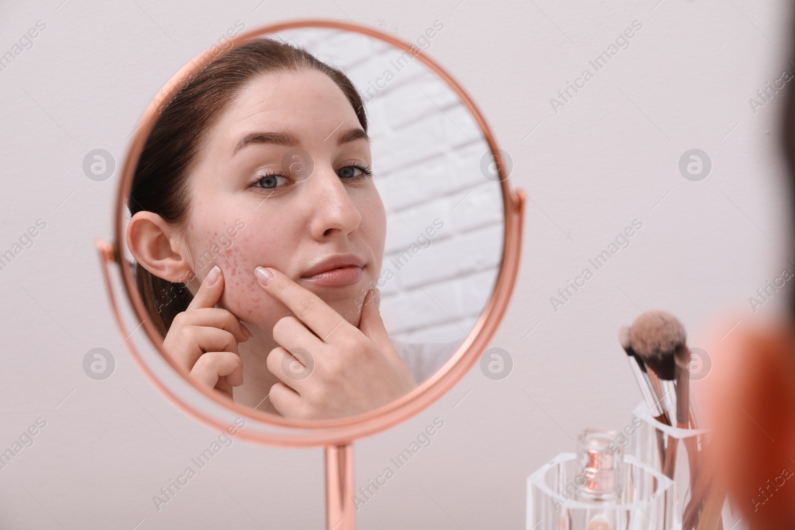 Photo of Woman with acne problem looking at mirror indoors