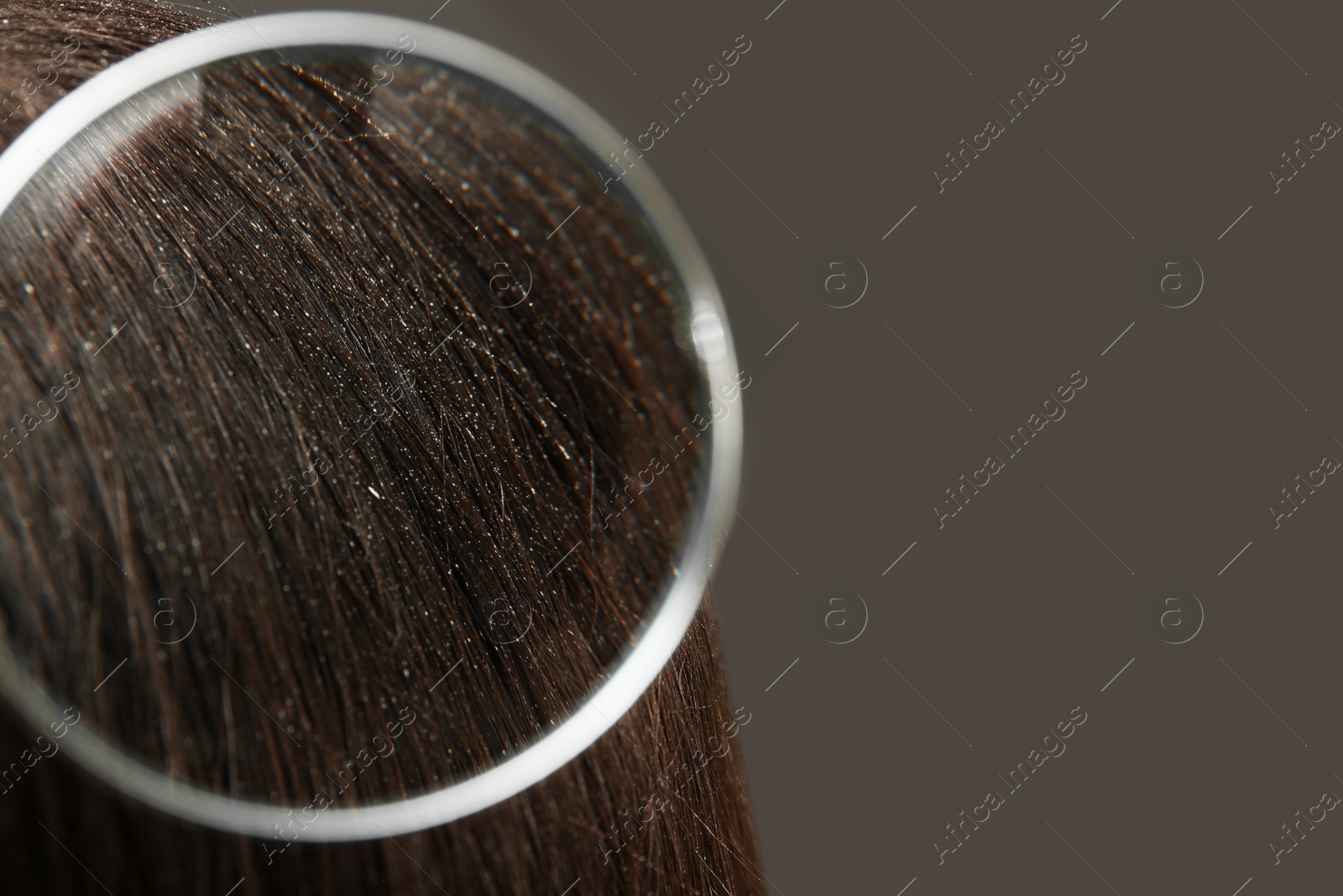 Photo of Closeup of woman with dandruff in her hair on grey background, view through magnifying glass. Space for text