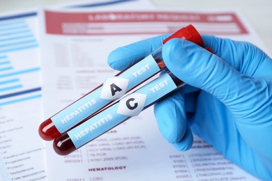 Photo of Scientist holding tubes with blood samples for hepatitis virus test near laboratory form, closeup