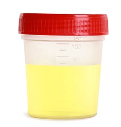 Container with urine sample for analysis on white background
