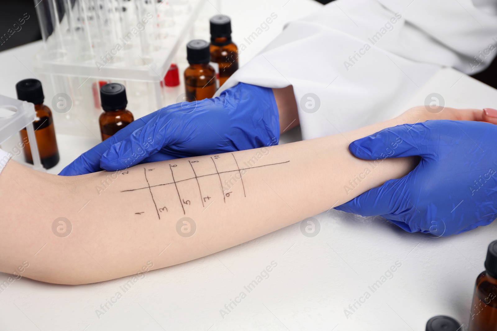 Photo of Doctor doing skin allergy test at light table, closeup