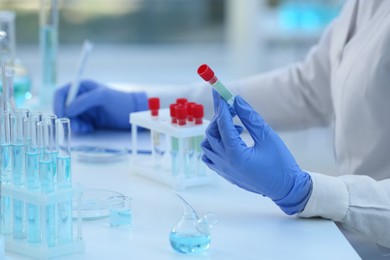 Photo of Scientist working with sample in laboratory, closeup. Medical research