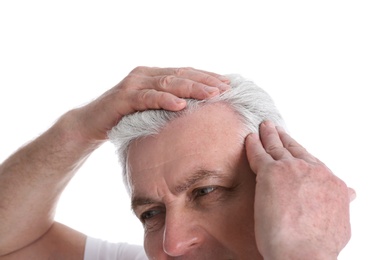 Senior man with hair loss problem isolated on white, closeup