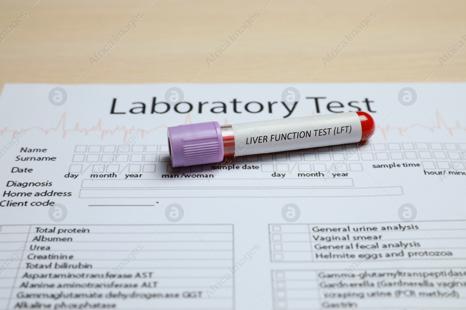 Photo of Liver Function Test. Tube with blood sample and laboratory form on table