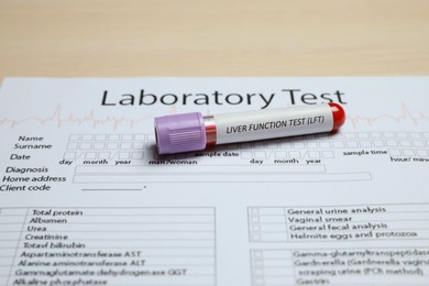 Liver Function Test. Tube with blood sample and laboratory form on table