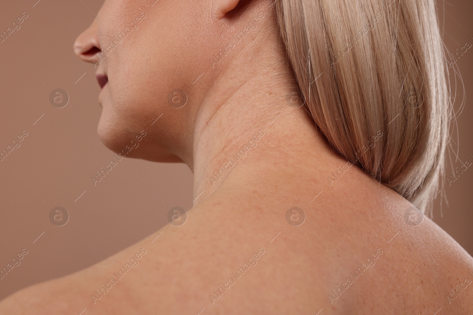 Photo of Back view of woman with healthy skin on beige background, closeup