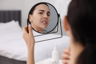 Photo of Woman with dry skin looking at mirror indoors